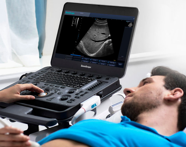 ¿Ecógrafo portátil o estacionario? Elige el equipo adecuado para tus necesidades médicas