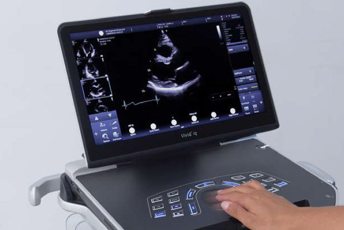 Top 7 de los mejores equipos ecógrafos portátiles