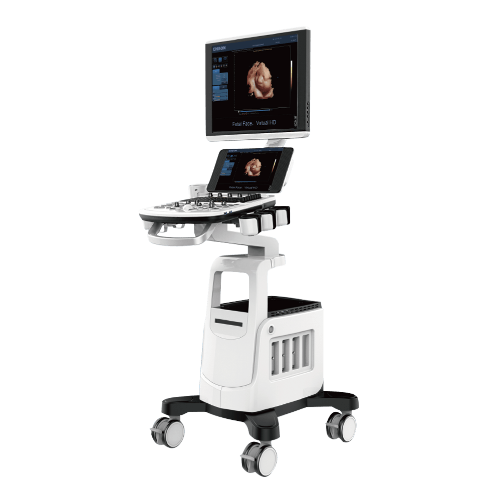 ecógrafo chison cbit 4