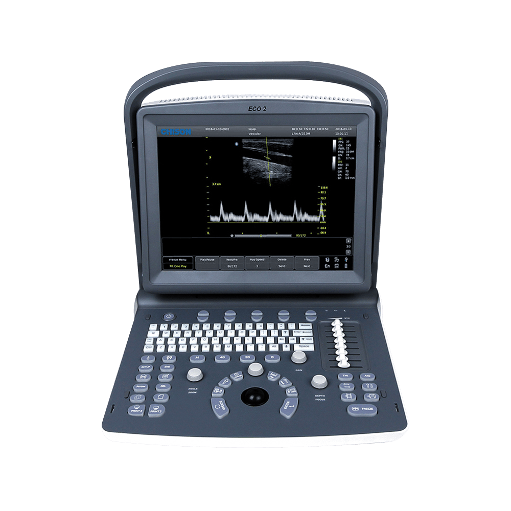 Ecógrafo SonoScape X1 – Global Ultrasonido