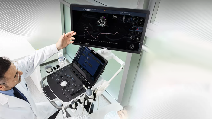 Transformando la Imagenología Médica: Ecógrafo CHISON SonoMax 9