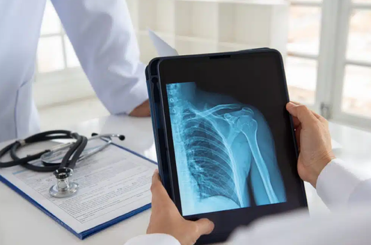 Radiología digital: ventajas y funcionamiento
