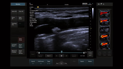 Ecógrafo Siemens Acuson P500