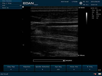 Ecógrafo Edan U50 VET