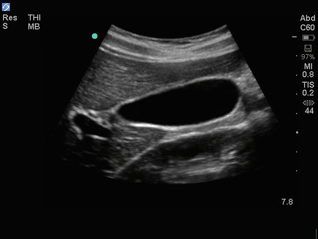 Ecógrafo Sonosite M Turbo