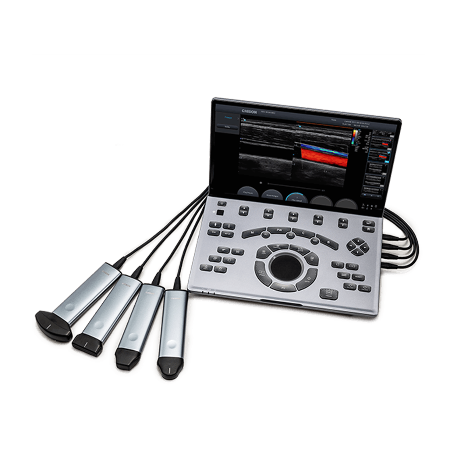 Chison – Global Ultrasonido Chison – Global Ultrasonido