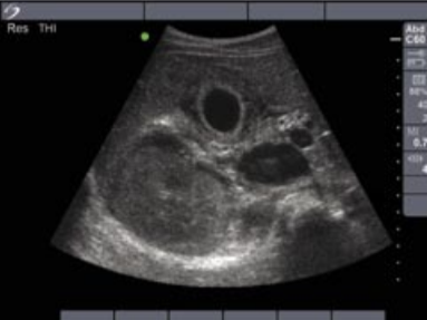 Ecógrafo Sonosite Micromaxx