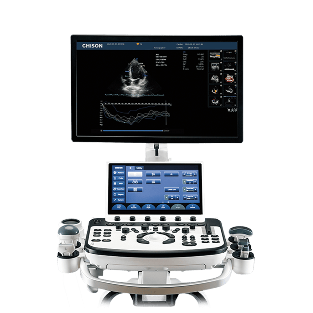 Ecógrafo Chison XBit 90