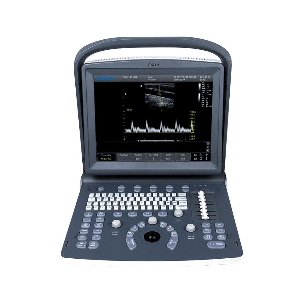 Ecógrafo Chison ECO 2 VET