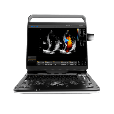ecógrafo chison eBit 60