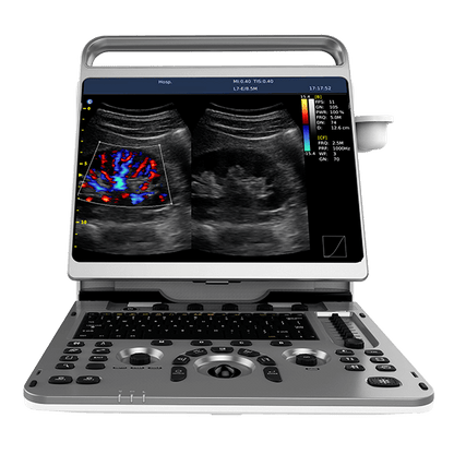 Ecógrafo Chison EBit 50