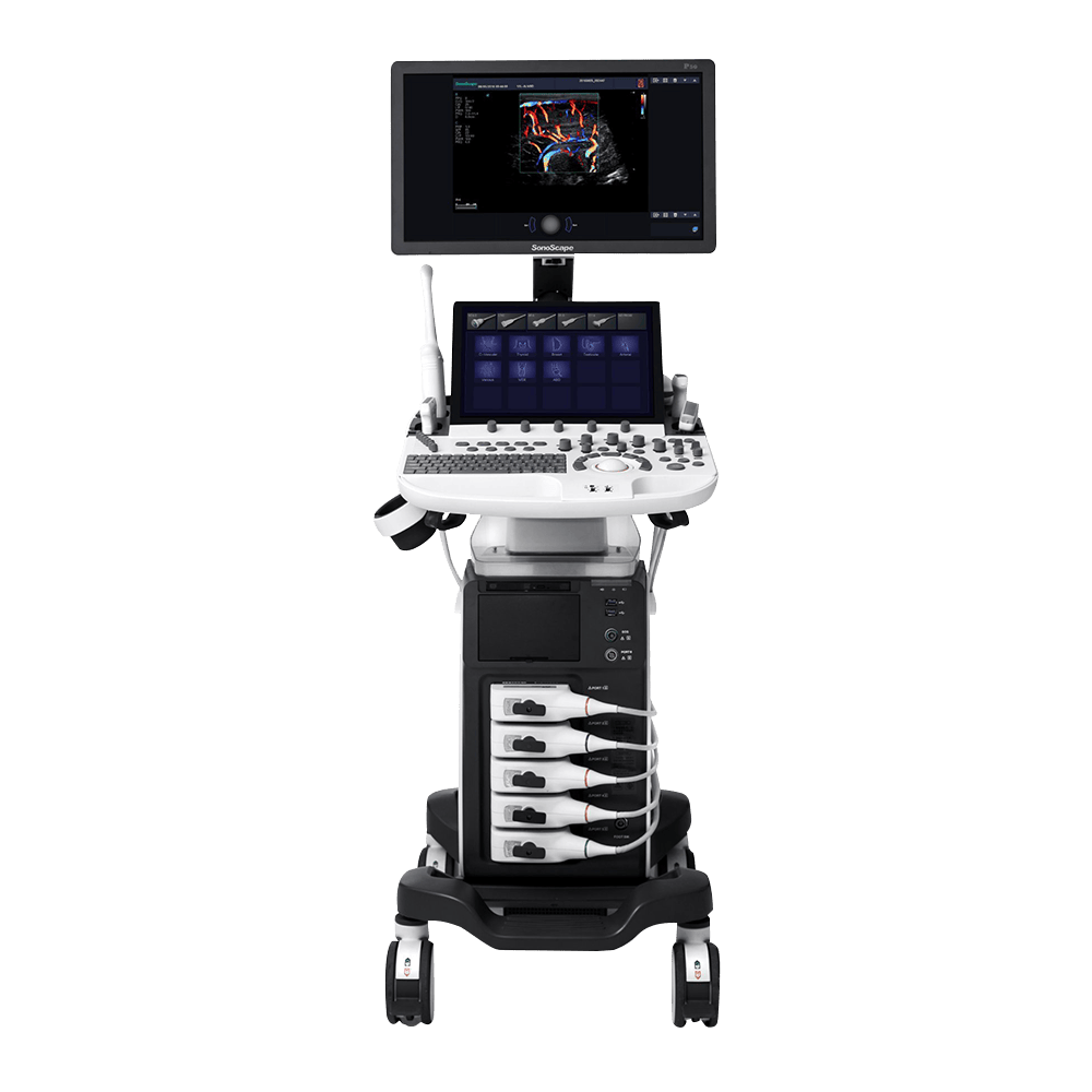 Ecógrafo SonoScape P40