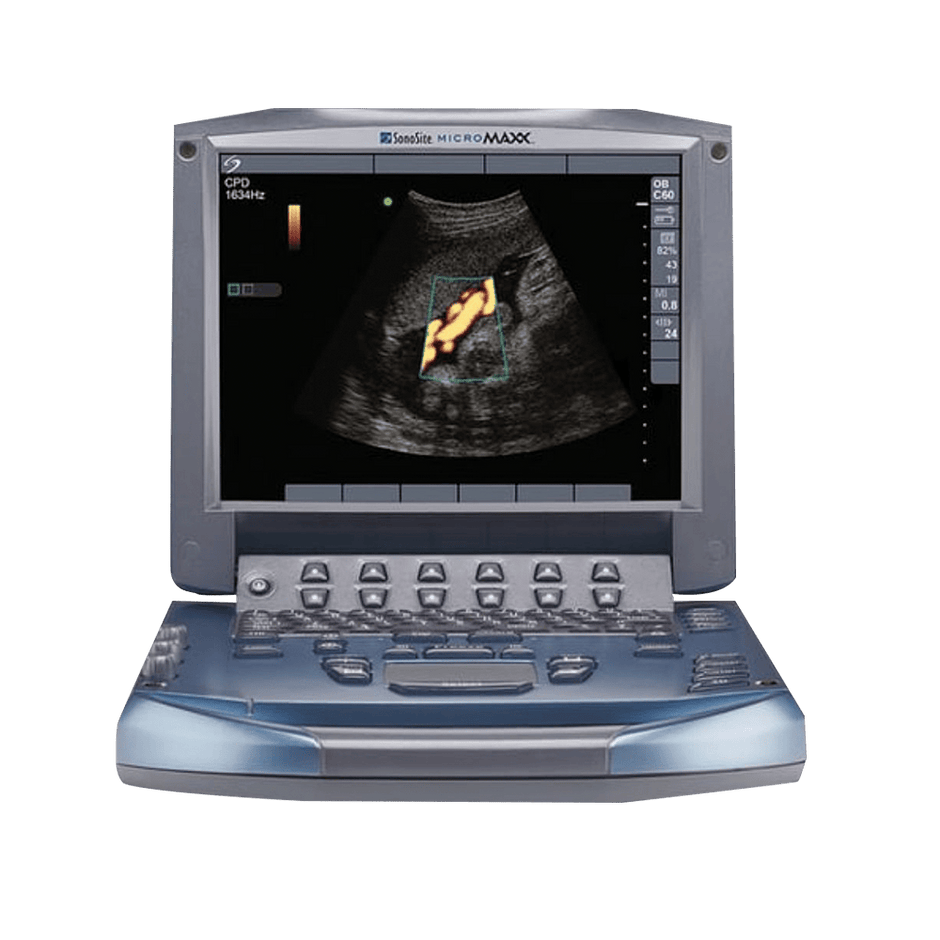 Refurbished 2008 Sonosite M-Turbo Ultrasound System with three probes and a stand – ECG