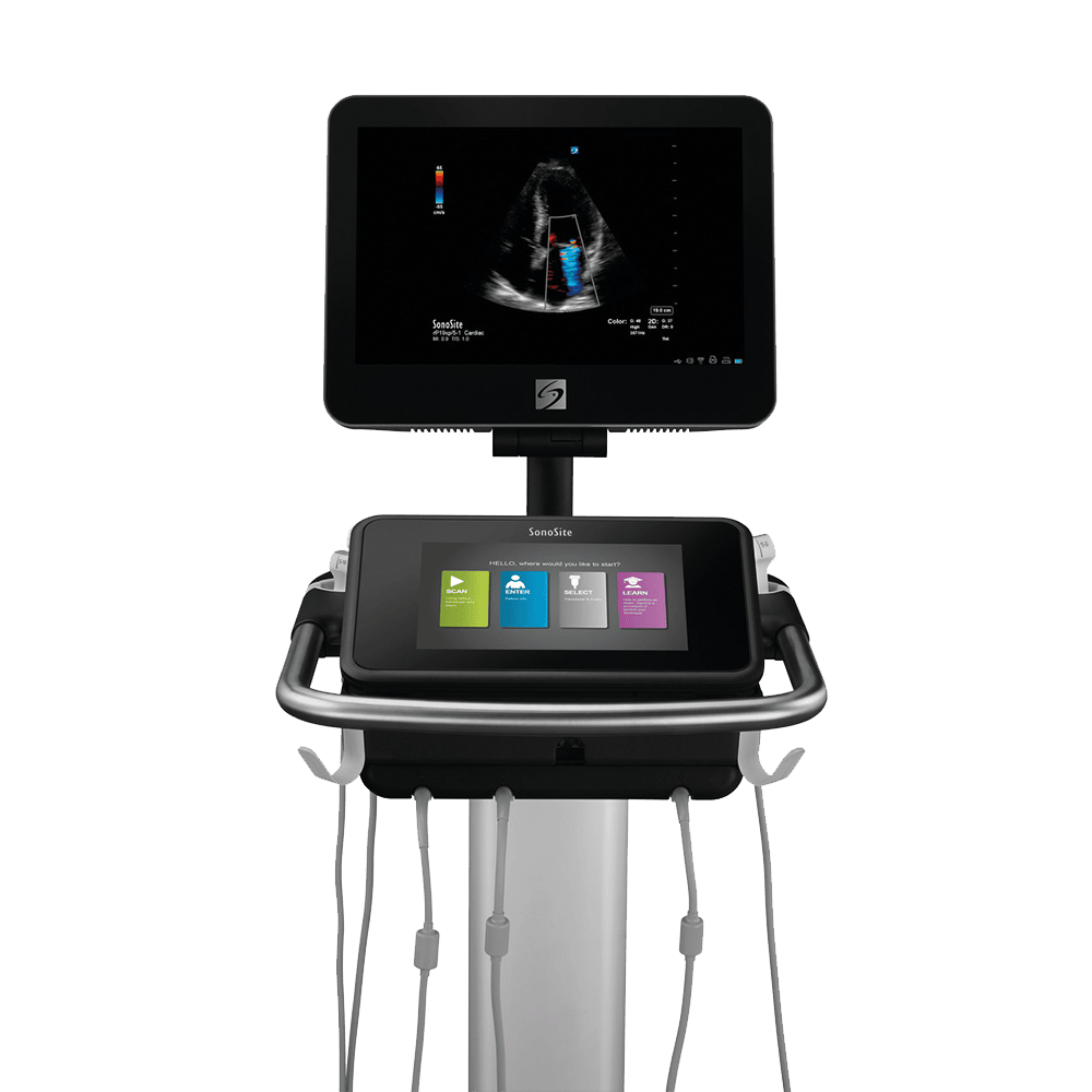 Ecógrafo Sonosite X-Porte