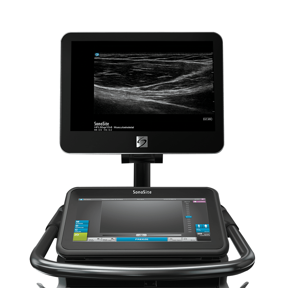 Ecógrafo Sonosite X-Porte